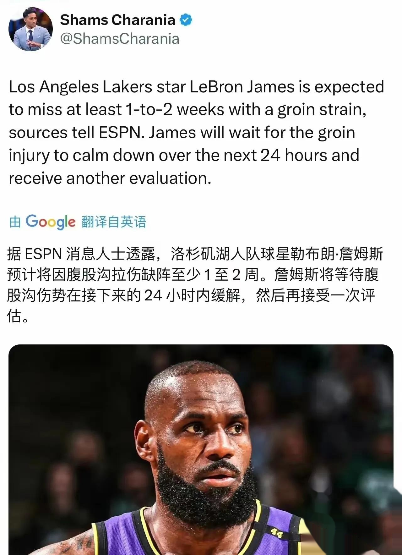 包含湖人遭遇连败，詹姆斯持续爆发的词条